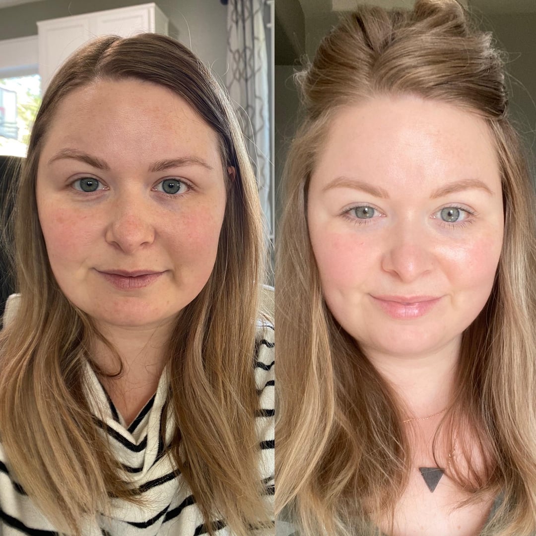 How Soon Will I Notice Change After Gluten‑Free? Reddit