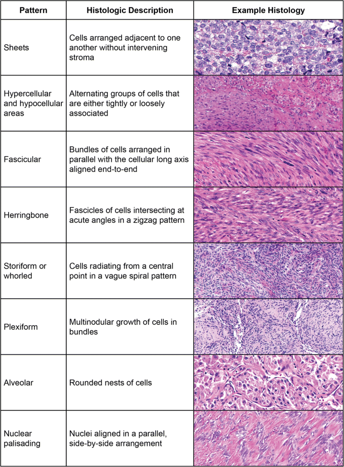 Pediatric Soft Tissue Tumors Pathology – Quick Guide