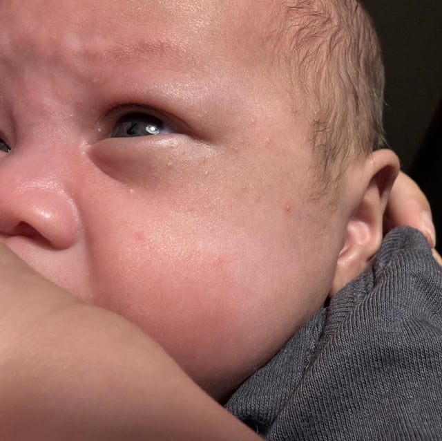 Reflux and Constipation Baby: Causes, Relief & Care