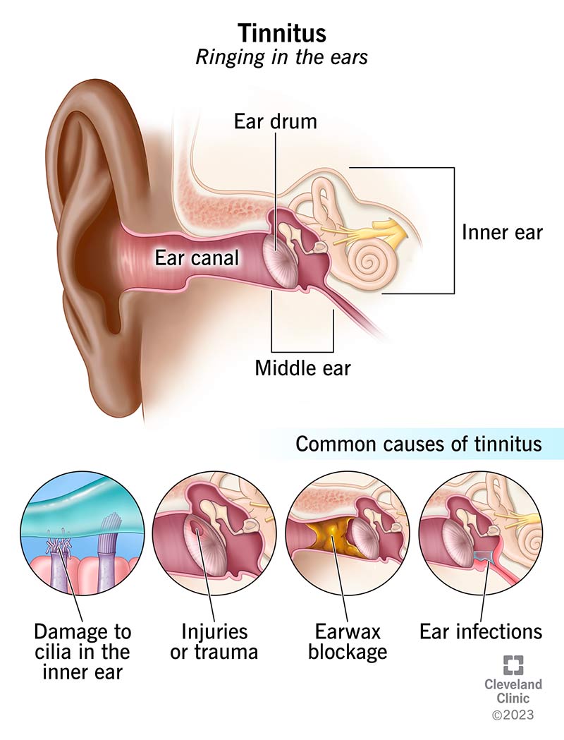 Ringing in One Ear Only: What It Means & How to Stop
