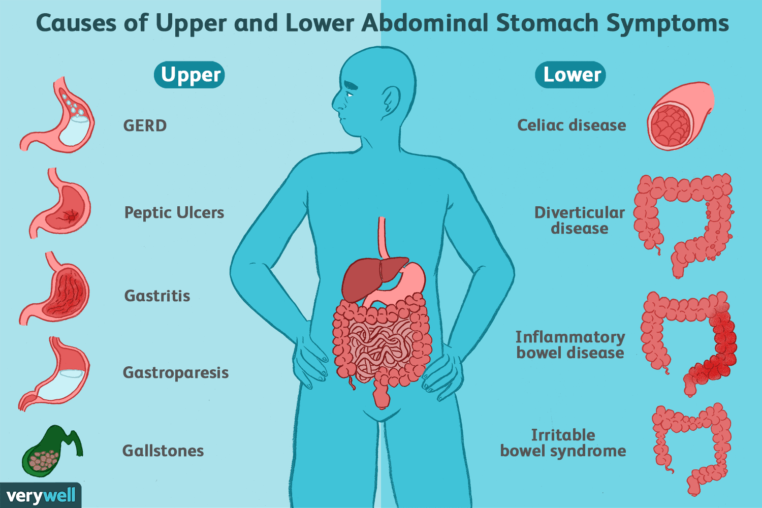 Signs of Stomach Problems in Adults – What to Watch For