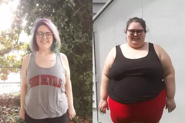 Weight loss after kidney removal: What you need to know