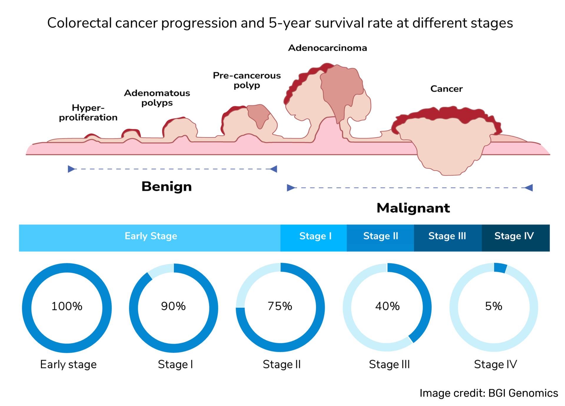 What Is the Genetic Test for Colon Cancer? Your Friendly Guide
