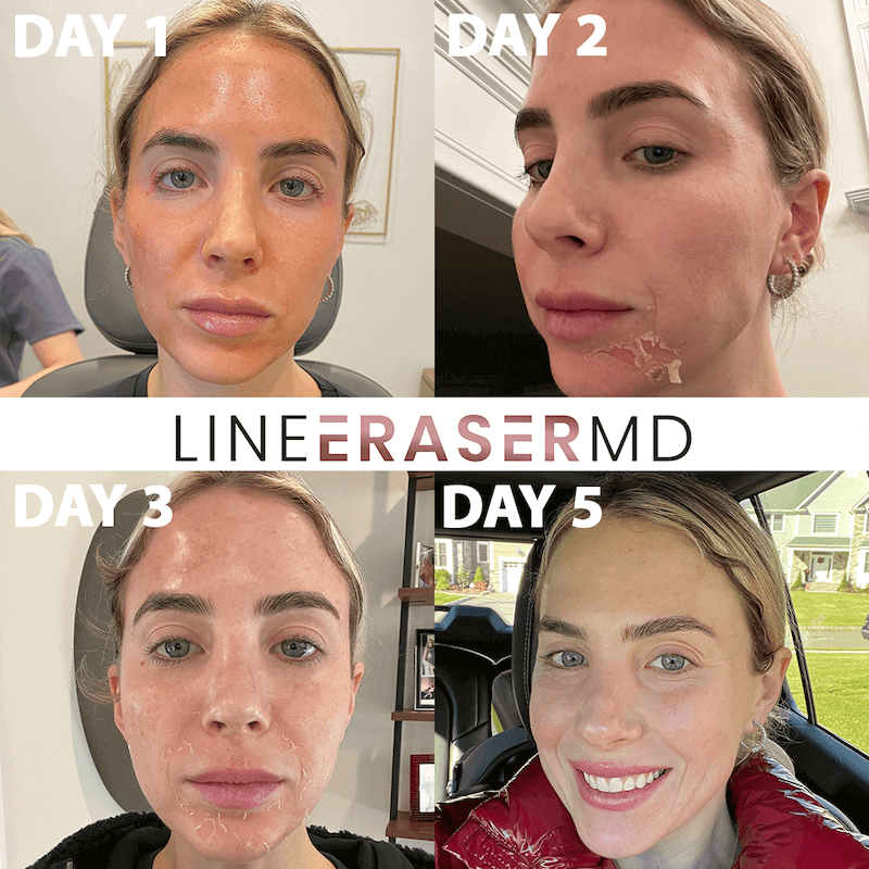 Best Anti Aging Facials: Top Picks for 2025