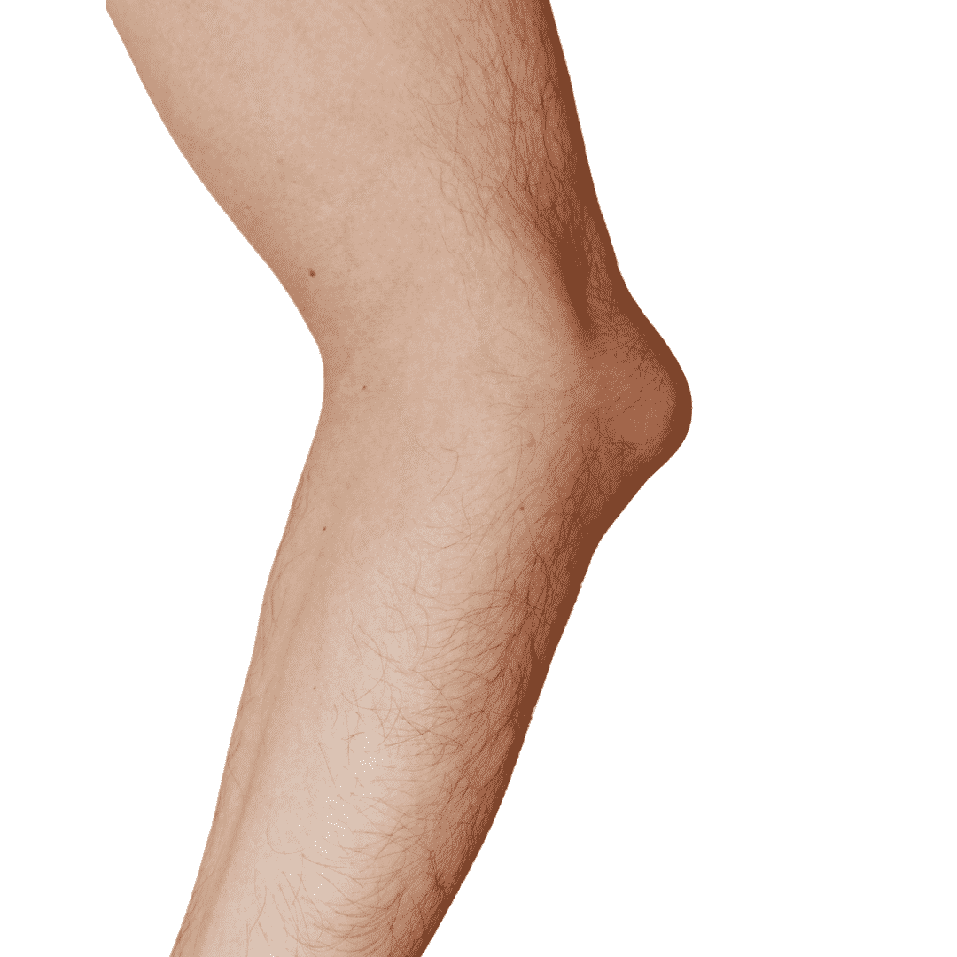 Can I Drain My Own Elbow Bursitis? Need to Know
