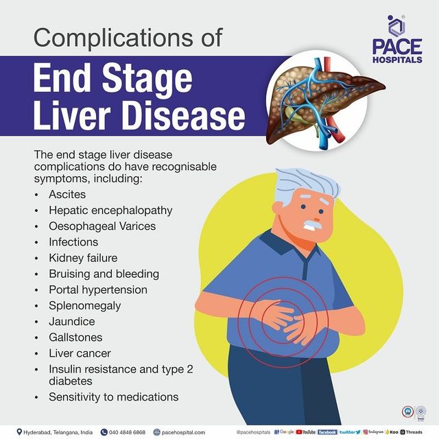 Understanding End‑Stage Liver Disease Low Platelet Count