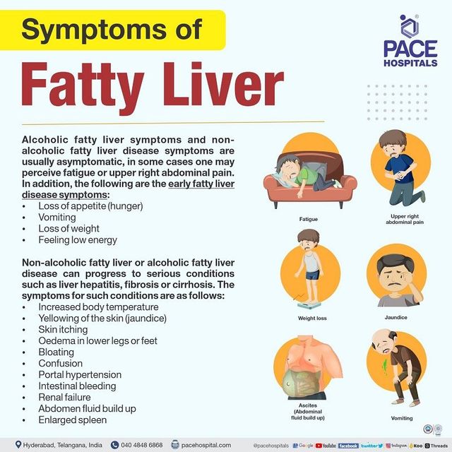 Fatty Liver Symptoms in Females Treatment Guide