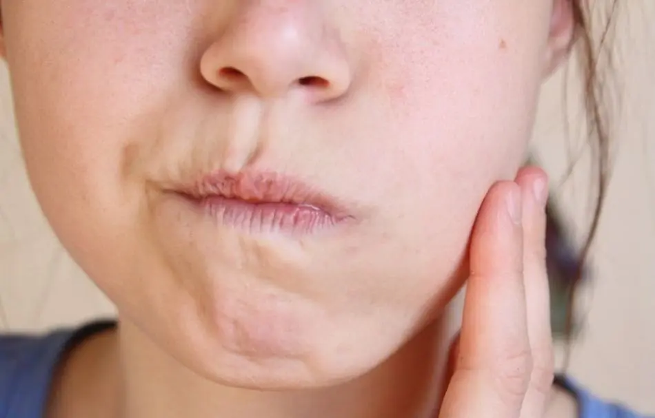 How to Bring Down Swelling in Face From Tooth – Fast, Safe Relief
