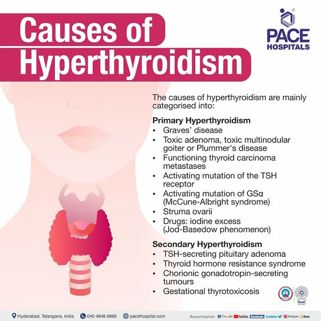 Hyperthyroidism Causes: Triggers of an Overactive Gland