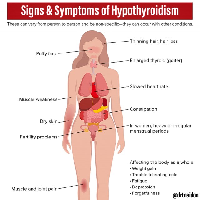 Hypothyroidism Symptoms: 7 Warning Signs to Notice