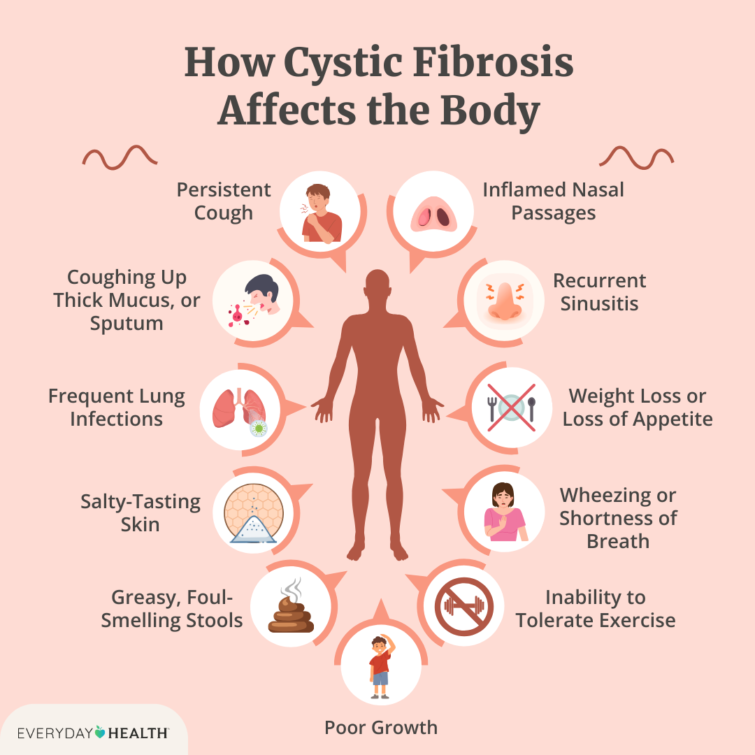 Is cystic fibrosis contagious through kissing? Answer