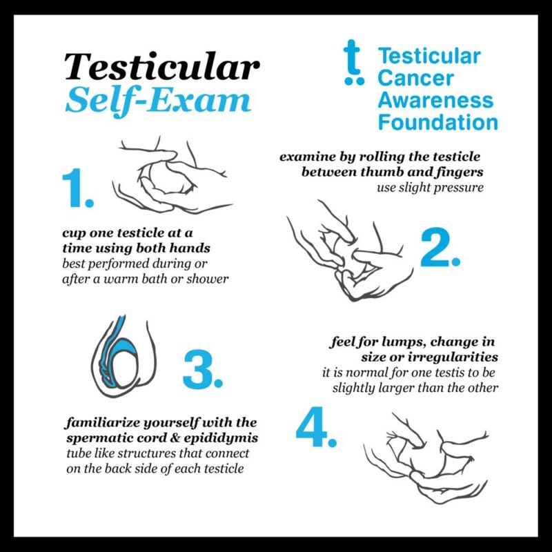 Late Stage Testicular Cancer Symptoms – Key Signs