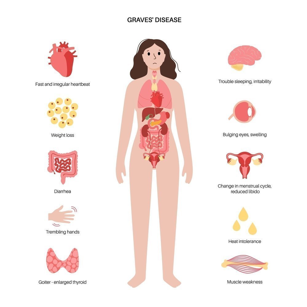 Thyroid in Stomach Symptoms in Female: Essential Guide
