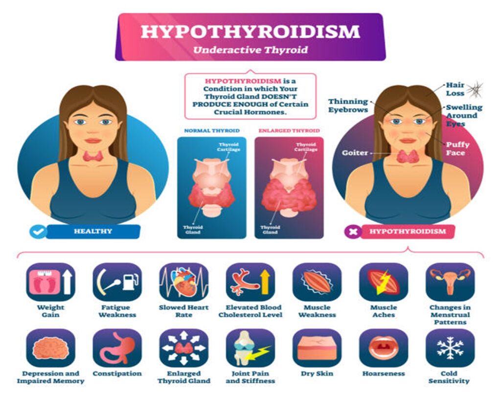 Thyroid Symptoms in Female Pregnancy: Essential Guide