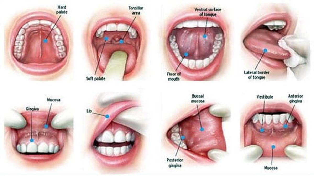 Types of Mouth Cancer Photos – What to Look For