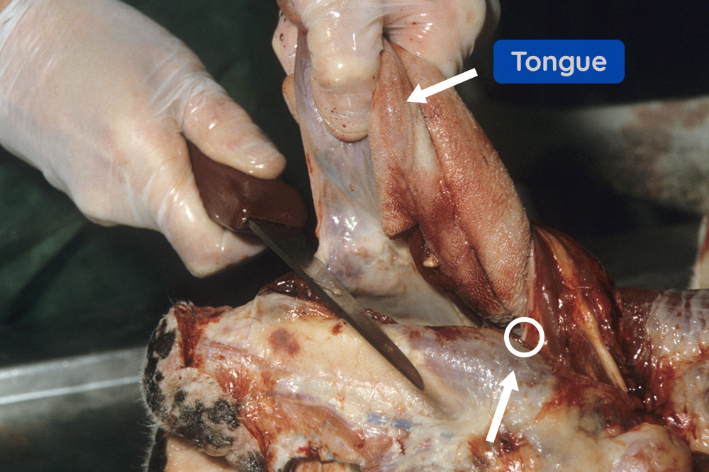 Why is the tongue removed during autopsy? Explained