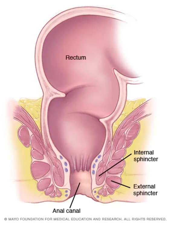Anal Cancer Pictures: What They Look Like & Why