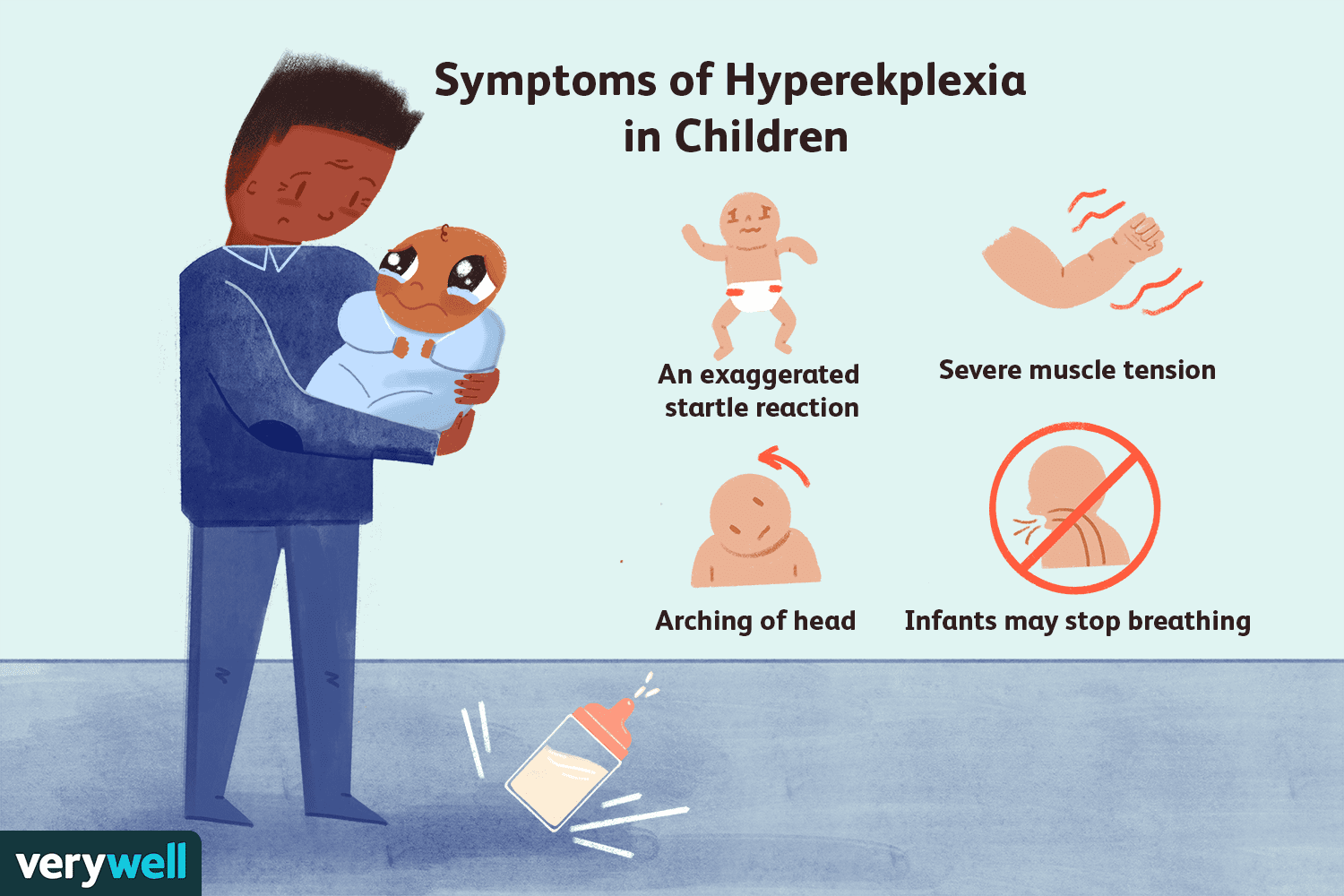 Hyperekplexia Symptoms in Babies: Essential Guide