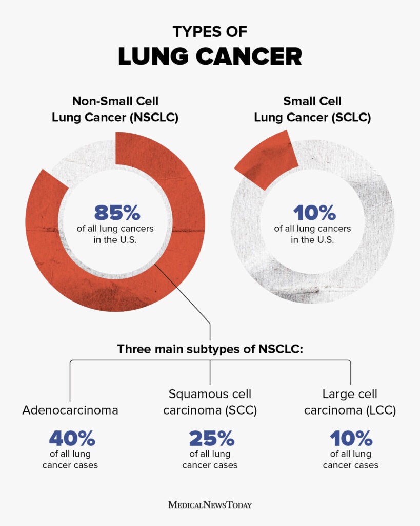 Non Small Cell Lung Cancer Survival Rate Explained