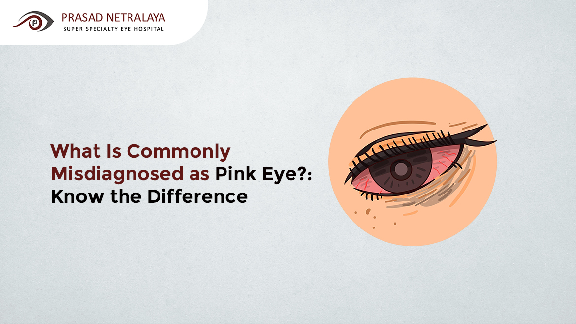What Is Commonly Misdiagnosed As Pink Eye? Quick Guide