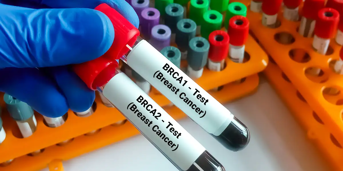 BRCA Testing Cost Without Insurance – Real Prices