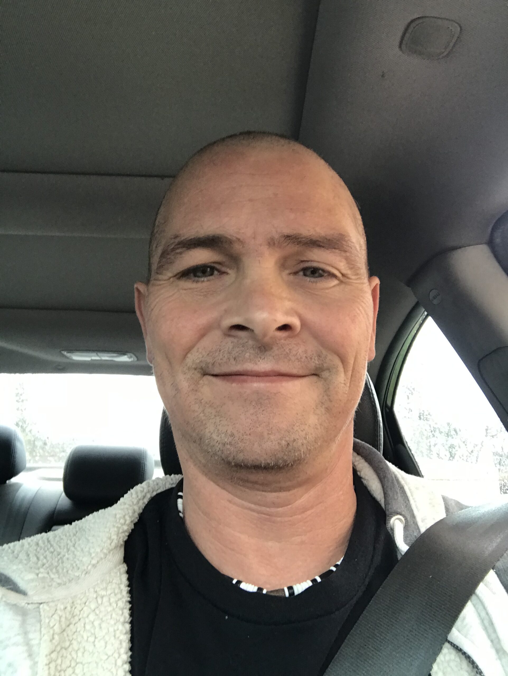 Longest Survivor of Cholangiocarcinoma: What We Learned