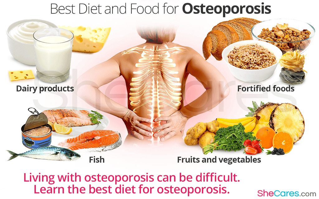 Osteoporosis Diet and Exercise: A Stronger Bones Guide
