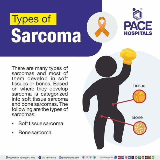 Understanding Pediatric Sarcoma Types: A Friendly Guide