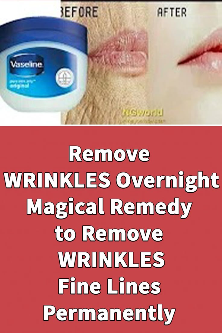Remove Wrinkles Overnight: Easy Tricks That Really Work