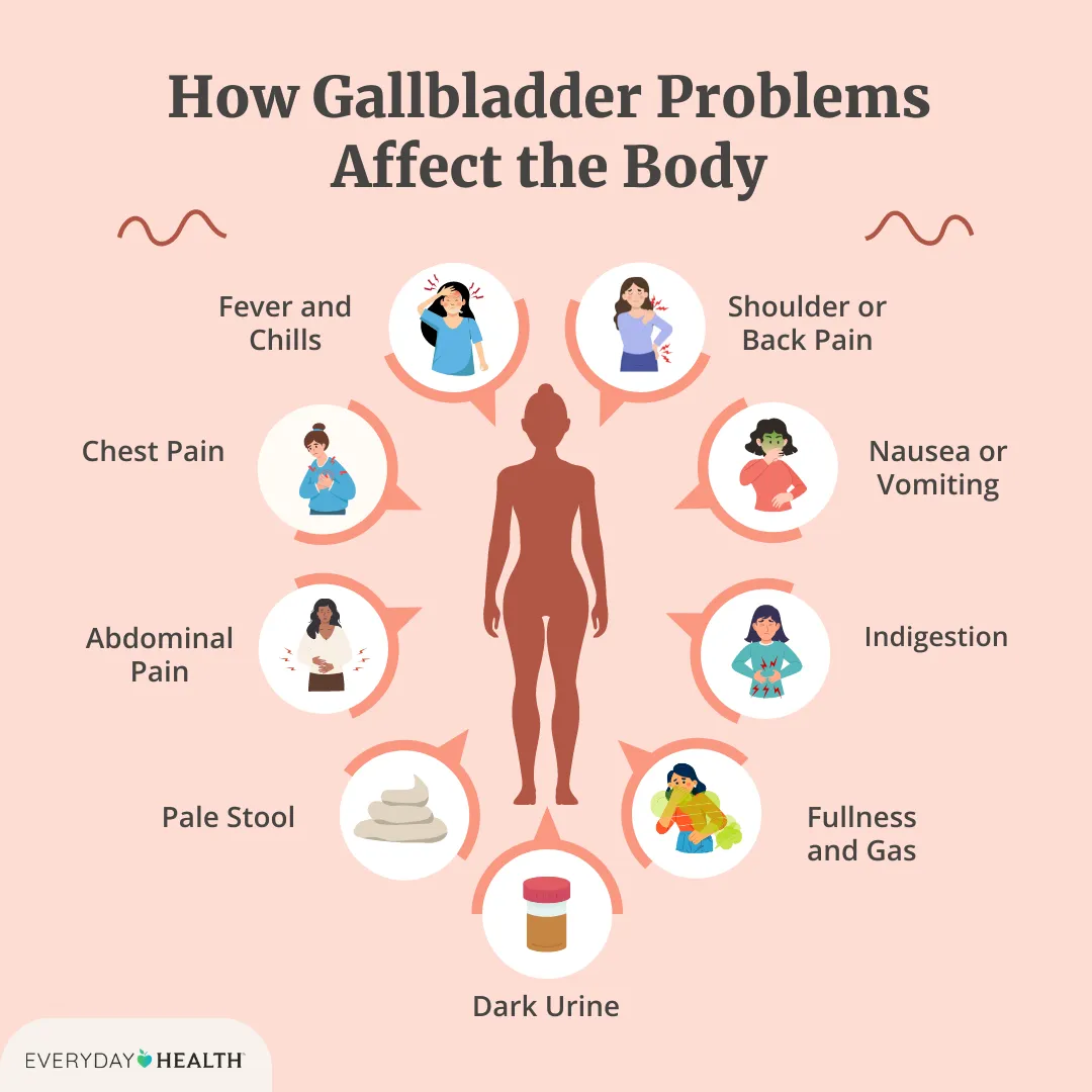What Are the 10 Symptoms of a Gallbladder Attack?