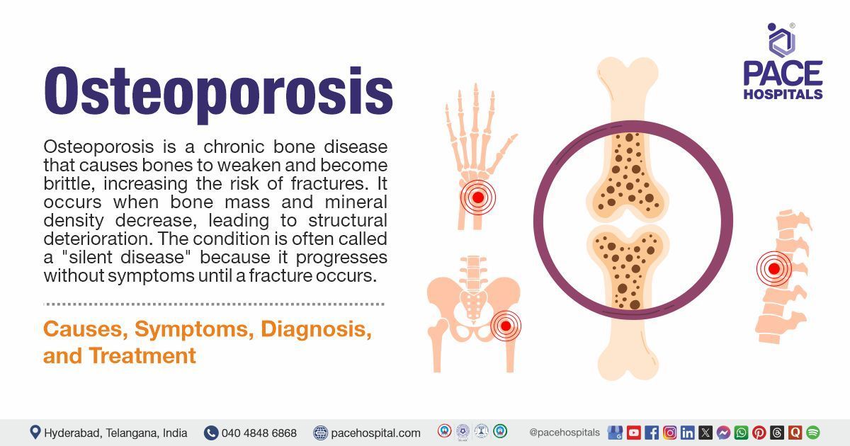 What Is the Main Cause of Osteoporosis? Explained