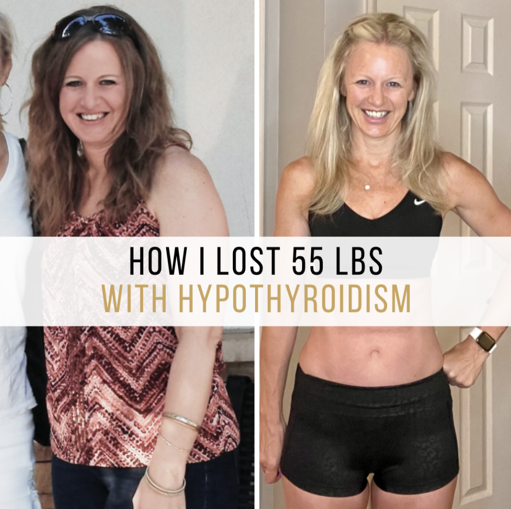 Can You Be Skinny with Hypothyroidism? Real Answers