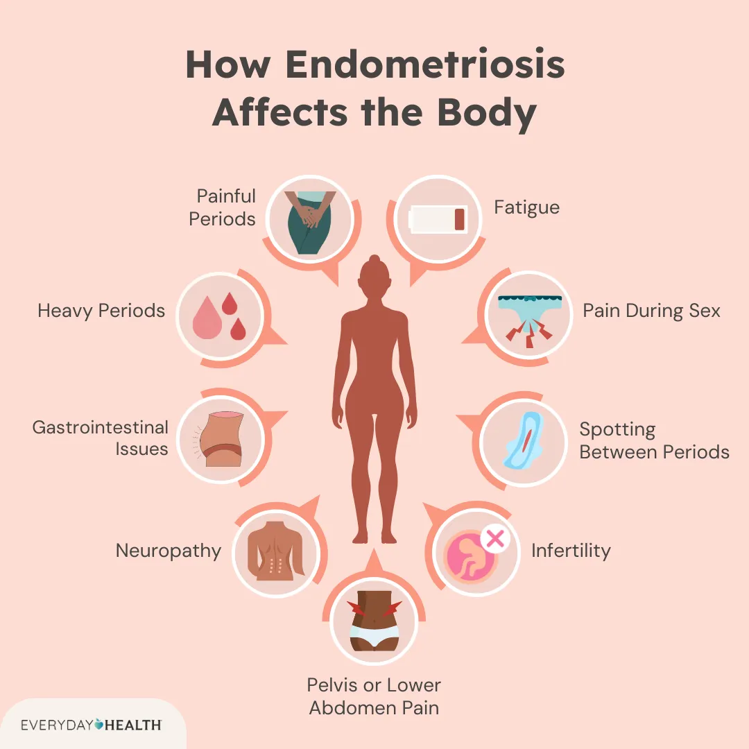 Endometriosis Symptoms: Spot the Signs & Take Control