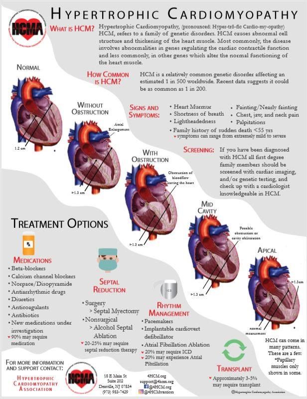 Is Hypertrophic Cardiomyopathy a Disability? Find Out