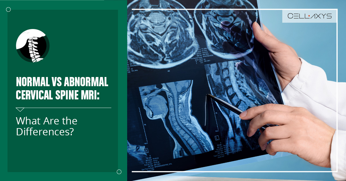 Normal vs Abnormal Cervical Spine MRI Explained Today