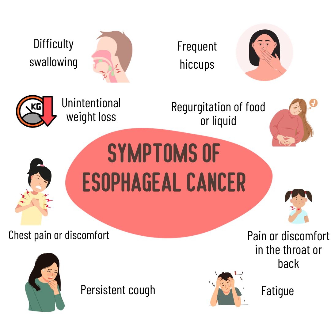 Esophageal Cancer Symptoms: What to Watch For