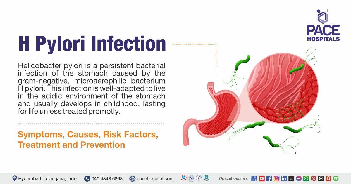 Types of Stomach Infections H. pylori: What You Need to Know
