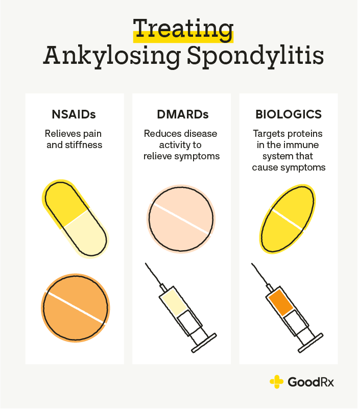 What Is the Latest Treatment for Ankylosing Spondylitis?