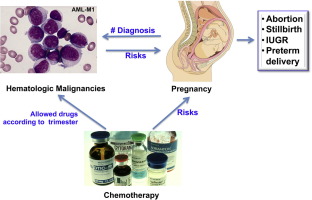 Acute Myeloid Leukemia in Pregnancy: Essential Facts