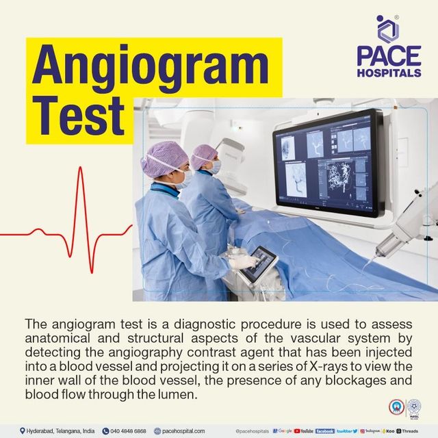Angiogram Cost: What You Need to Know Today in the USA