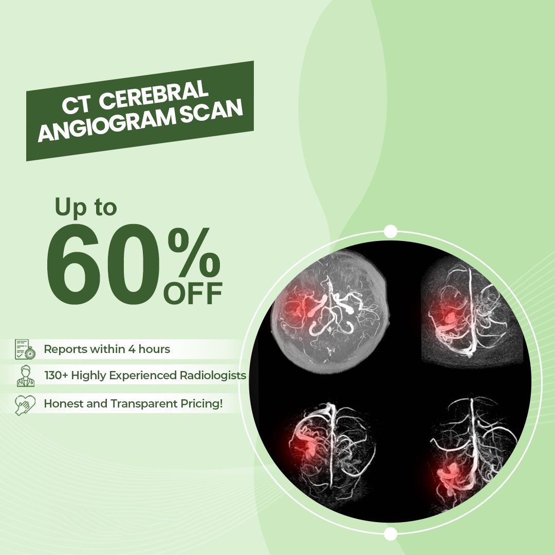 Brain Angiogram Cost: What You Need to Know Today