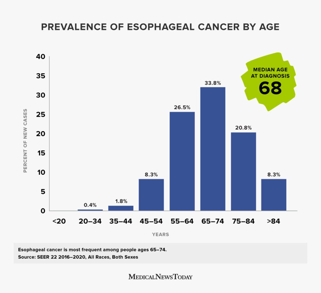 Your Chances of Esophageal Cancer by Age – Quick Guide