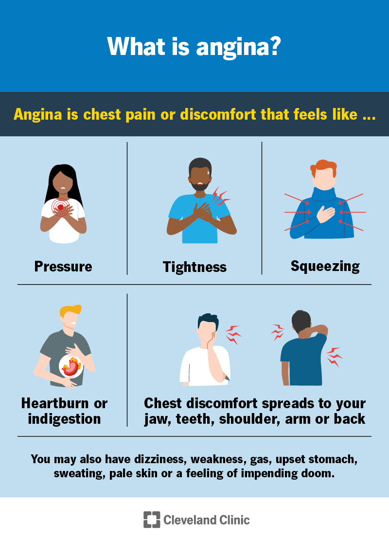 Chest Pain That Comes and Goes: What It Means