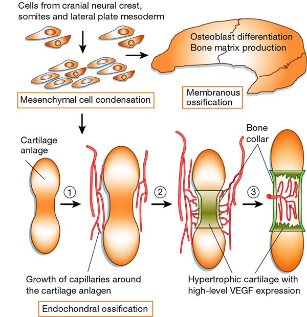 Genetic Bone Diseases: Your Friendly Complete Guide