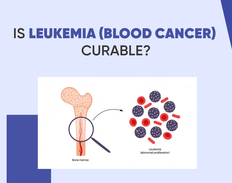Is leukemia curable? Facts, rates, and what to know