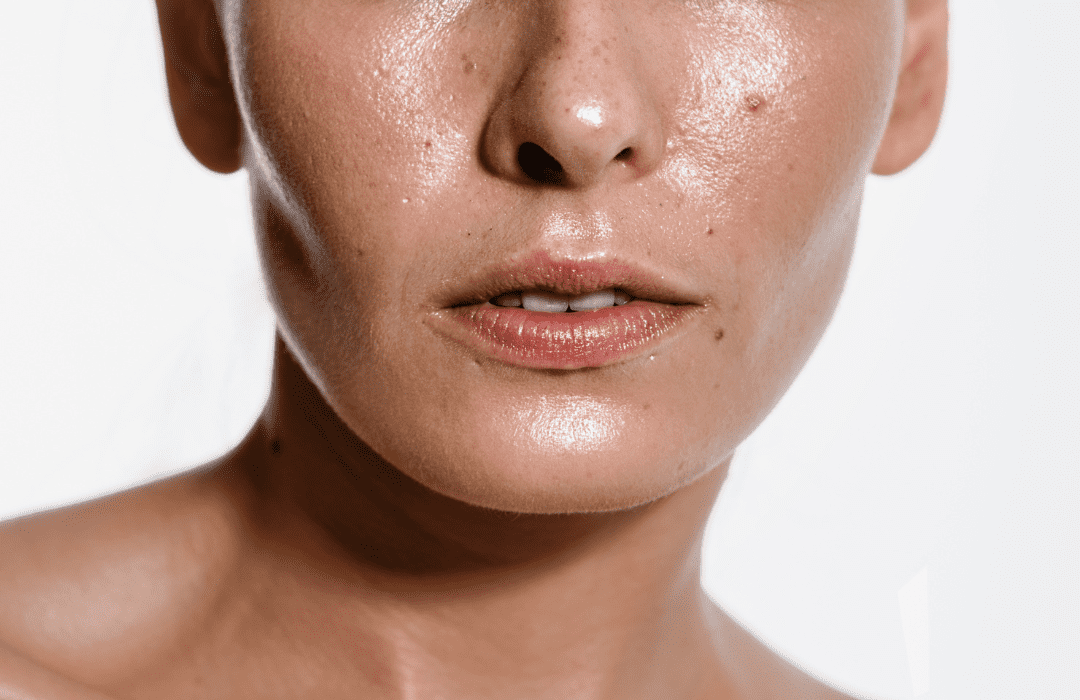 Is Oily Skin Good? Benefits, Risks & Simple Fixes