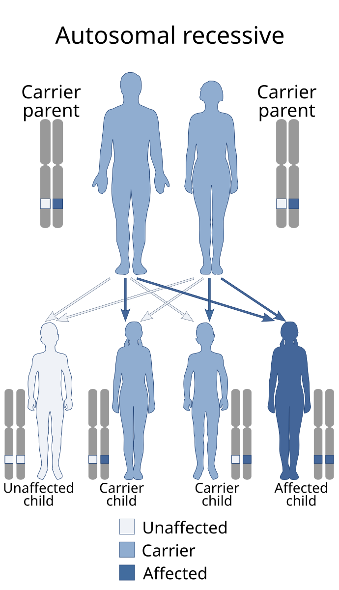 Is osteoporosis dominant or recessive? A clear guide