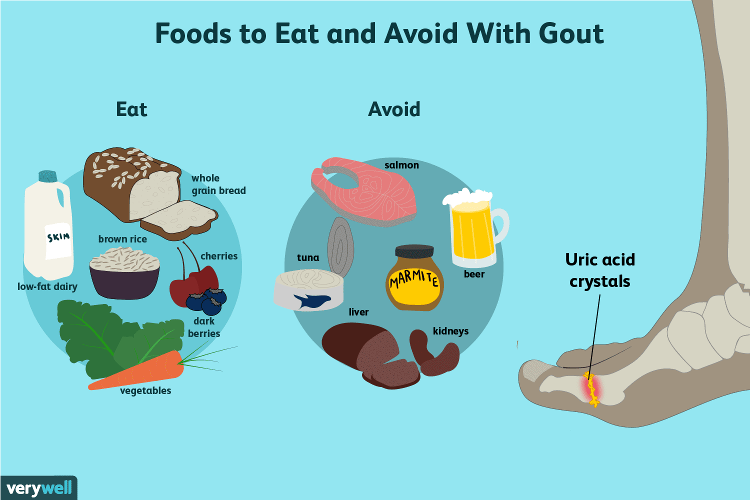 Is Salmon Bad for Gout? What the Science Says