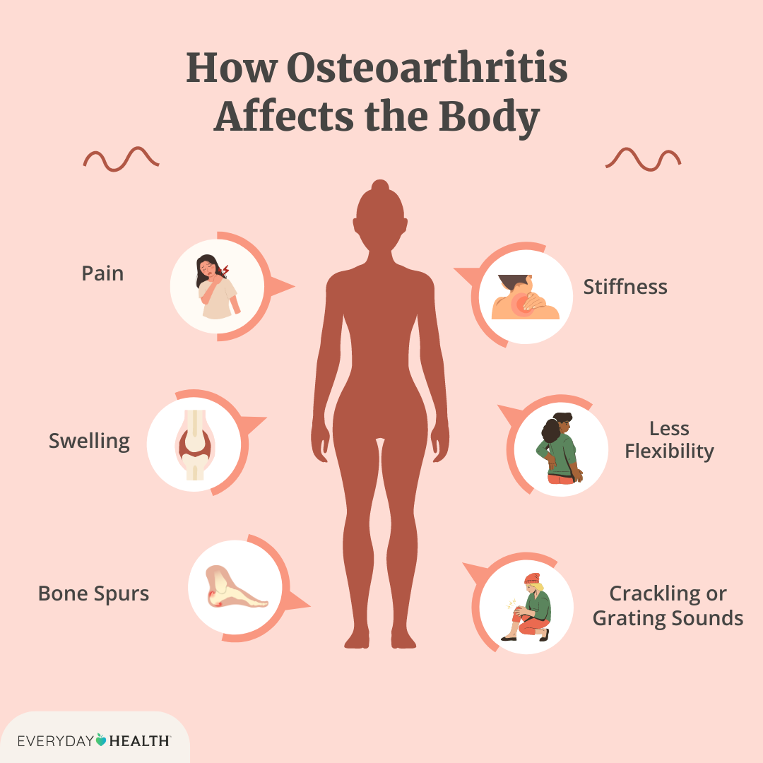 Osteoarthritis Symptoms: Spot Them Early & Take Control