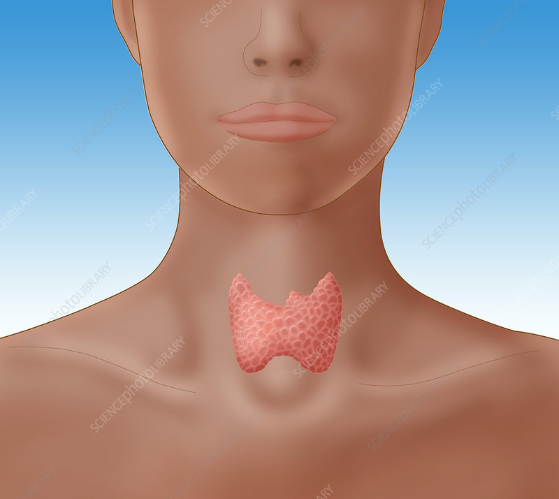 Thyroid Picture Woman: What Images Reveal About Health